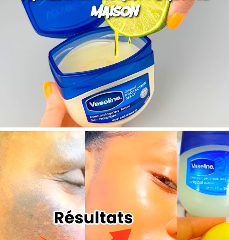 vaseline